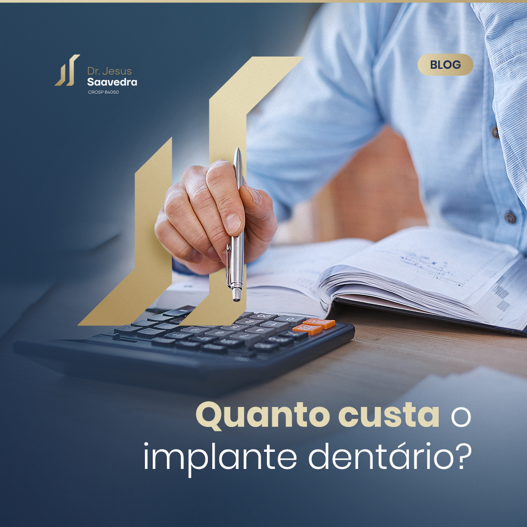 Qual o valor de um implante dentário?